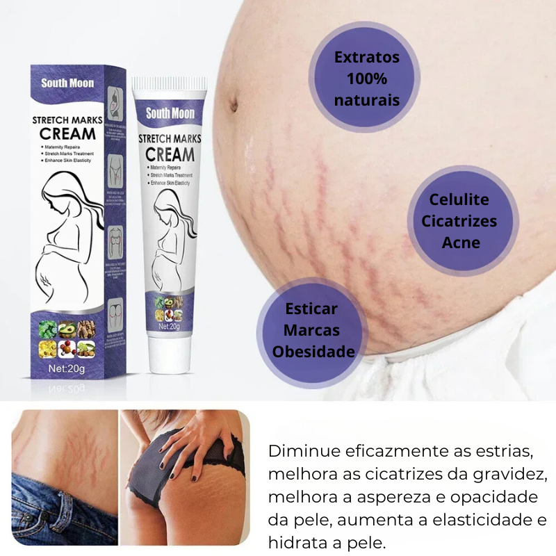 Creme Reparador para Estrias - Tratamento Anti-Rugas e Cuidados com a Pele para Gestantes