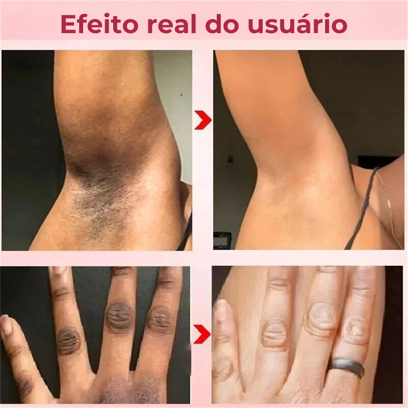 Creme Clareador para Coxas Internas - Clareia Axilas, Cotovelos e Joelhos | Hidrata e Suaviza a Pele"