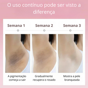 Creme Clareador para Coxas Internas - Clareia Axilas, Cotovelos e Joelhos | Hidrata e Suaviza a Pele"