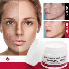 Clareador de sardas remove melasma manchas escuras, ilumina a pele e anti-envelhecimento