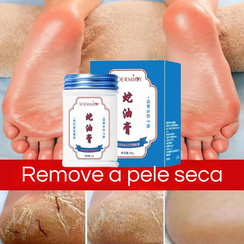 Creme Anti-Rachaduras para Pés - Reparo de Calcanhares, Esfoliação e Hidratação Intensa