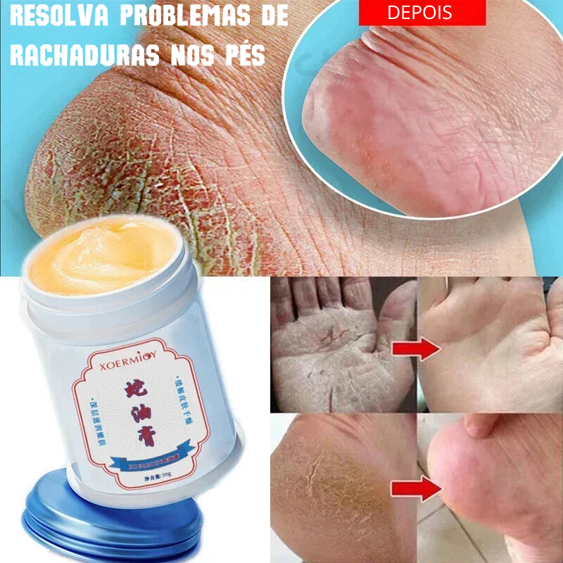 Creme Anti-Rachaduras para Pés - Reparo de Calcanhares, Esfoliação e Hidratação Intensa